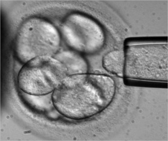 Embryonic Stem Cell Manipulation A picture of embryonic stem cells being manipulated