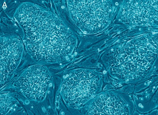 A picture of embryonic stem cells.